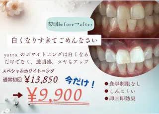ホワイトニングサロン yatto.のその他イメージ