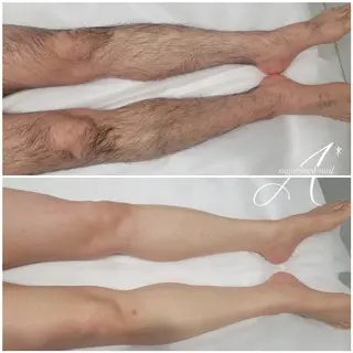 A*《エースター》 シュガーリング🍋のエステ・リラクイメージ