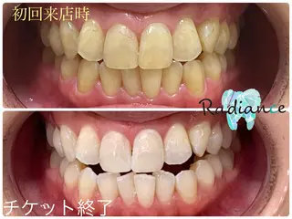 札幌ホワイトニング ラディアンス札幌駅店のその他イメージ