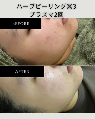 稲垣 優のエステ・リラクイメージ