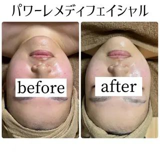 Nestime 豊川エステのエステ・リラクイメージ