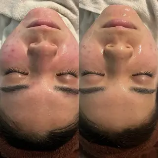 韓国肌管理 Belleのエステ・リラクイメージ