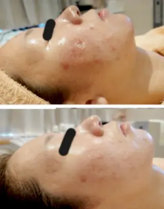 esthesalon O'-en-のエステ・リラクイメージ