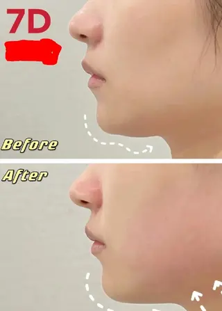 aliaハーブ水光店 エステティシャン募集のエステ・リラクイメージ