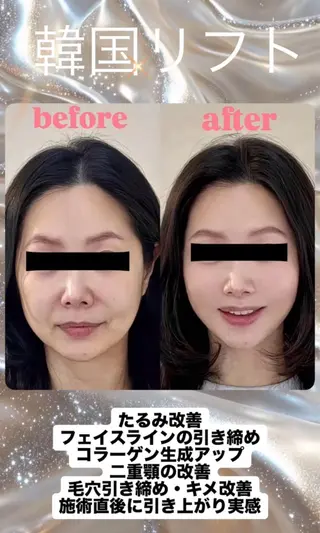 マツエク・マツパ 愛維美水光美肌専門店 メンズレディースokのエステ・リラクイメージ