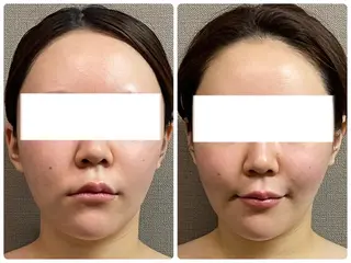 MIRAI小顔 岡山店のエステ・リラクイメージ