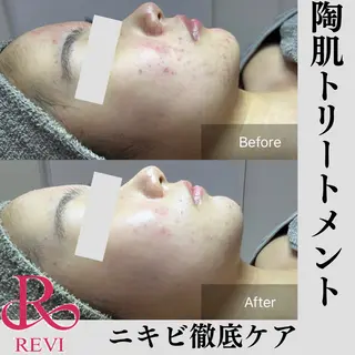 beauty salonWのエステ・リラクイメージ
