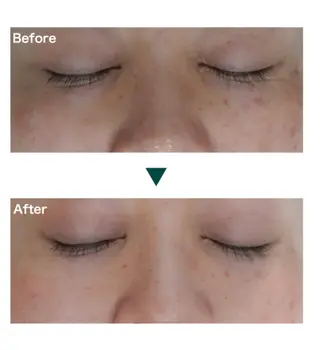 プライベートサロン belleのエステ・リラクイメージ