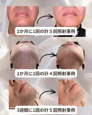 メンズ Maum SkinSalonのエステ・リラクイメージ