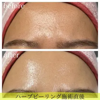 Kapua🌺 マユのマツエク・マツパデザイン