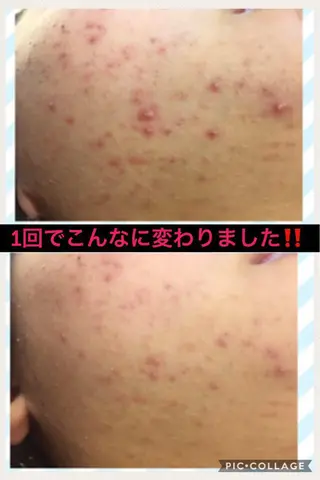 ミディアム カラー パーマ ヘアアレンジ メンズ キッズ ネイル マツエク・マツパ ニキビ・肌質改善専門 ♡人生が変わるサロンのエステ・リラクイメージ