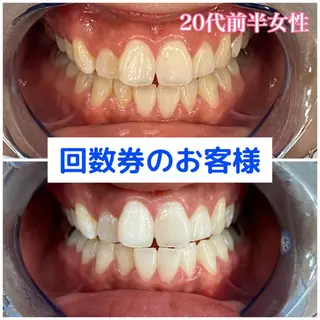 Platinum Beauty 四条烏丸店所属・吉田亮利 ホワイトニング専門店のその他イメージ