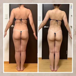 Vi's CLUB KOTONOのエステ・リラクイメージ