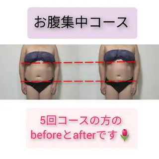 Alphaplus AYAMI のエステ・リラクイメージ