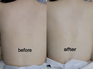 肌ケア＆毛穴洗浄 Cheri/女性専用のエステ・リラクイメージ