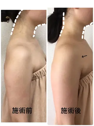 美筋骨格リンパ®️ Aroleのエステ・リラクイメージ