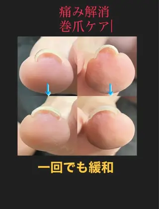 ネイル ネイルスペースR 小林のネイルデザイン