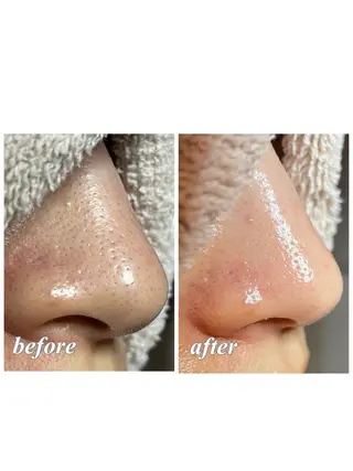 結果重視｜毛穴エステ ｜友綱理恵のエステ・リラクイメージ