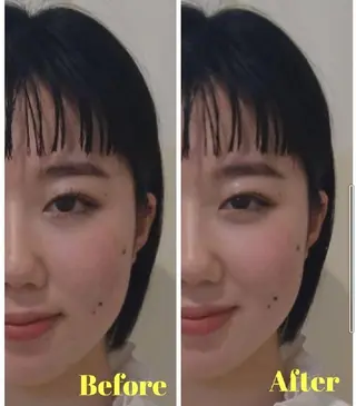 💙美容鍼💙美顔矯 正🧡Brilo🧡のエステ・リラクイメージ