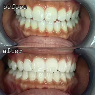 ネイル セルフホワイトニング 耳ツボジュエリーのエステ・リラクイメージ