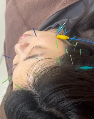 鍼灸整体サロンAIM所属・天王寺ニキビ専門 サロンAIMのエステ・リラクイメージ