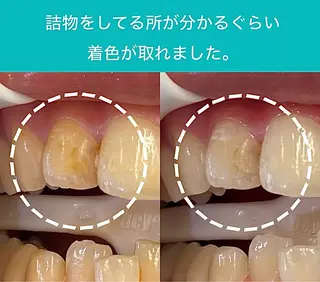 歯科医院提携 Retreatのエステ・リラクイメージ