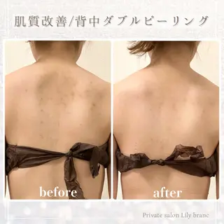 Lily branc 痩身/小顔/肌質改善のエステ・リラクイメージ
