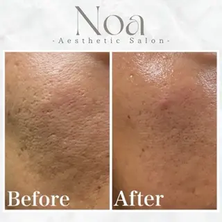 肌質改善サロン Noaのエステ・リラクイメージ
