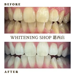 メンズ ホワイトニング ショップ葛西店のその他イメージ