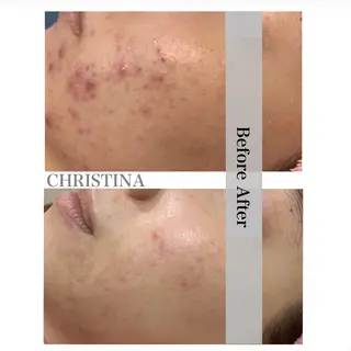 エステ矢野 ジョアアンジェ心斎橋のエステ・リラクイメージ