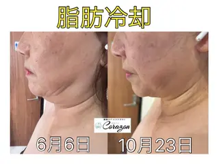 Corazon コラゾンのマツエク・マツパデザイン