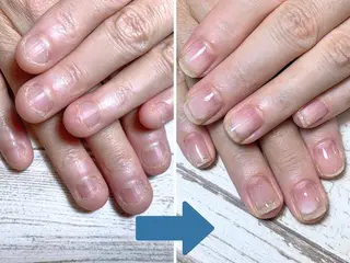 ネイル 深爪矯正・自爪育成 ネイルサロンアモまいのネイルデザイン