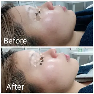 肌質改善Beauty salon Renのエステ・リラクイメージ