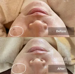 メンズ キッズ 美肌と癒しのサロン Lu,Mieのエステ・リラクイメージ