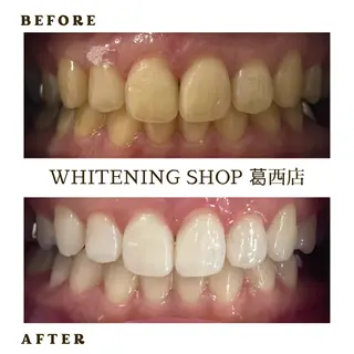 メンズ ホワイトニング ショップ葛西店のその他イメージ