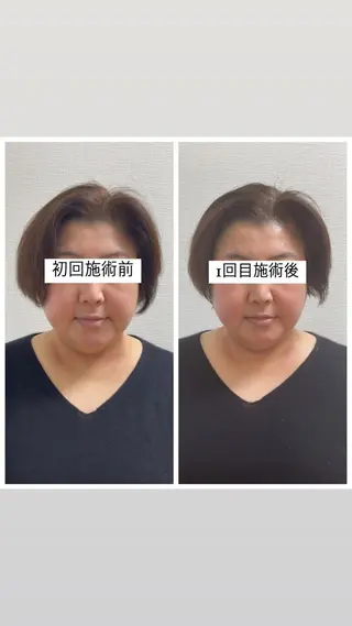 エクラヴィ 小顔・エイジングケアのエステ・リラクイメージ