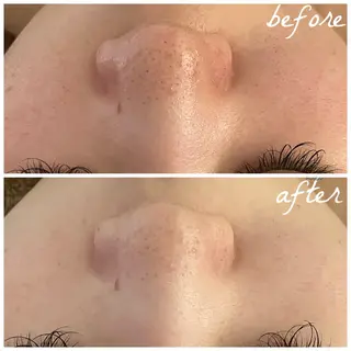 メンズ メナード岐阜市茜部 杉浦のエステ・リラクイメージ