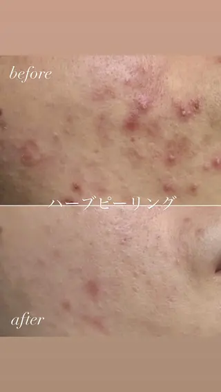 肌質改善サロン réposのその他イメージ