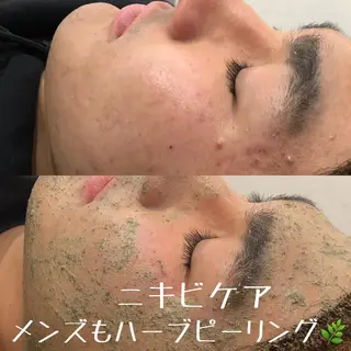 小顔矯/美容鍼/鍼灸 BeauJuのその他イメージ