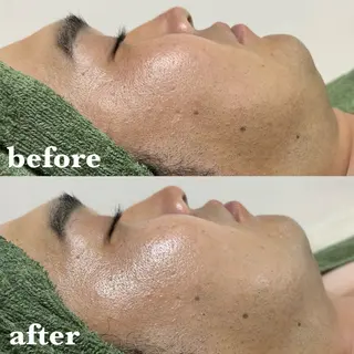 メンズ 肌質改善＆脱毛 【M Mondo】のエステ・リラクイメージ