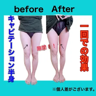 痩身/脱毛/ネイル HARUKAのエステ・リラクイメージ