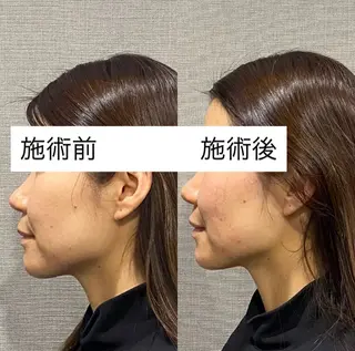 肌質改善専門 ハーブ /毛穴洗浄 リエイトのエステ・リラクイメージ