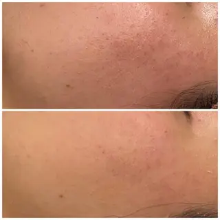 セミロング カラー パーマ ヘアアレンジ メンズ ネイル マツエク・マツパ アイブロウ 3か月で肌革命👼 ニキビ専門店💫のエステ・リラクイメージ