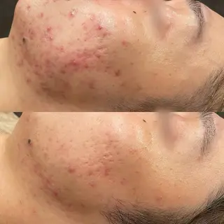 Re:Belle所属・Re:Belle 久留米 : 中島のエステ・リラクイメージ