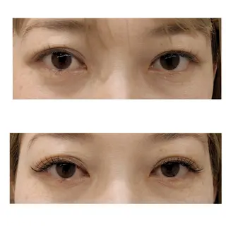 マツエク・マツパ akane .のその他イメージ