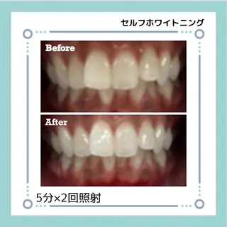 Nail salon Adorerのエステ・リラクイメージ