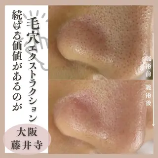 Muqu. 毛穴サロンのエステ・リラクイメージ