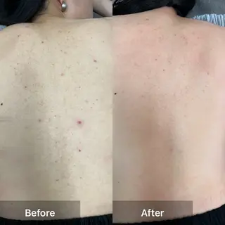 ハーブピーリング 専門店MOKA所属・ハーブピーリング専門 MOKAのエステ・リラクイメージ