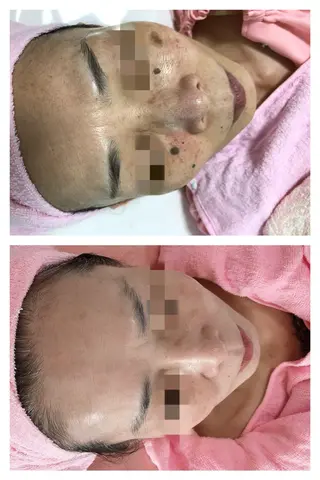 顔専門エステ プリエールビューティのエステ・リラクイメージ