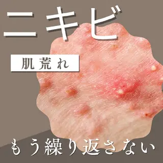 エステサロン NICOLIのエステ・リラクイメージ